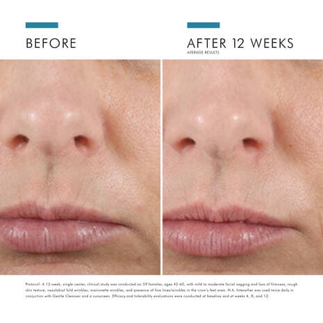 SkinCeuticals H.A. Intensifier - Shopthatapp.ca
