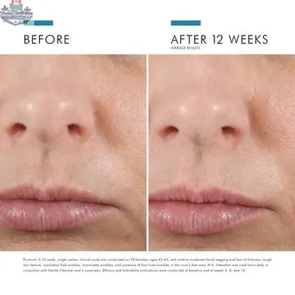 SkinCeuticals H.A. Intensifier serum bottle for enhanced hydration and skin firmness, displayed on a clean surface.