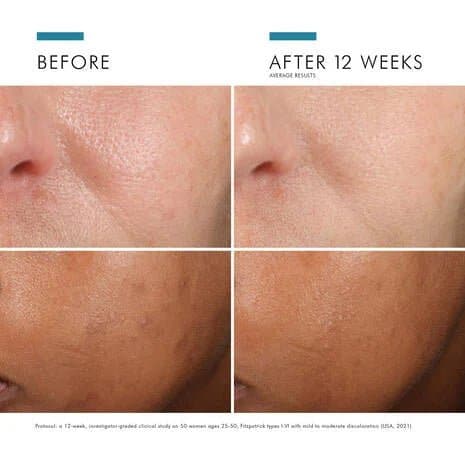 SkinCeuticals Phloretin CF - Shopthatapp.ca