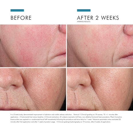 SkinCeuticals Phyto Corrective Essence Mist - Shopthatapp.ca