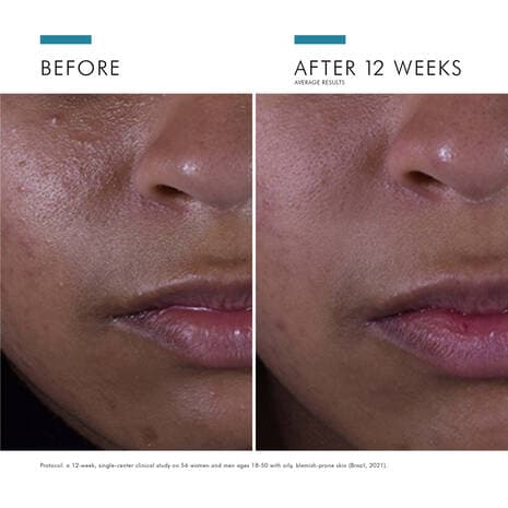 SkinCeuticals Silymarin CF - Shopthatapp.ca