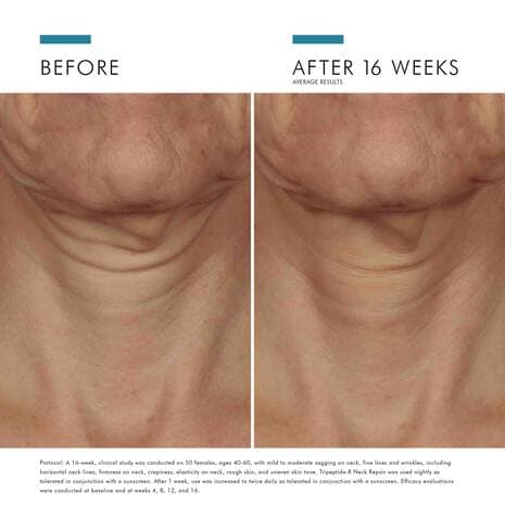 SkinCeuticals Tripeptide-R Neck Repair - Shopthatapp.ca