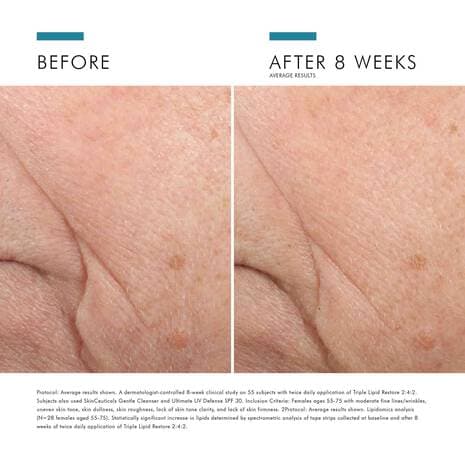 SkinCeuticals Triple Lipid Restore 2:4:2 - Shopthatapp.ca