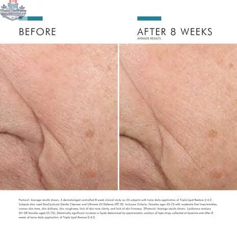 SkinCeuticals Triple Lipid Restore 2:4:2 moisturizer jar with product label, highlighting nourishing skincare for skin renewal.