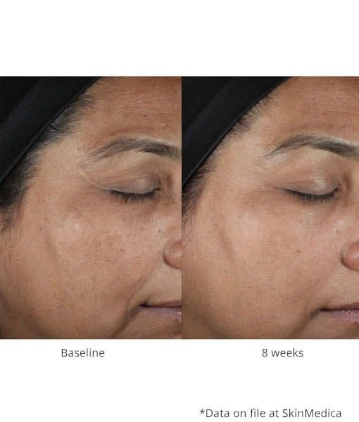 SkinMedica Lumivive™ System Day+Night - Shopthatapp.ca