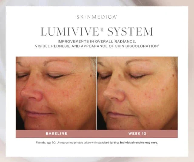 SkinMedica Lumivive™ System Day+Night - Shopthatapp.ca