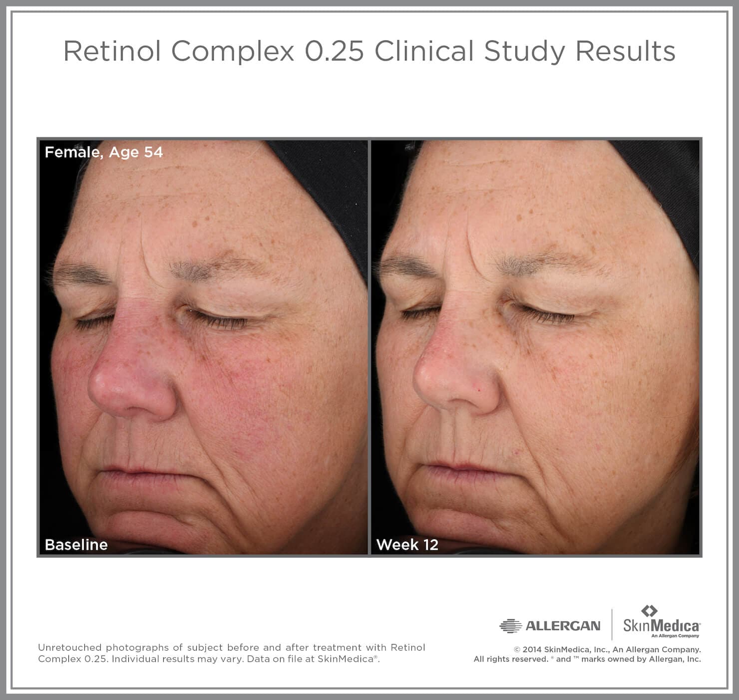 SkinMedica Retinol Complex - Shopthatapp.ca
