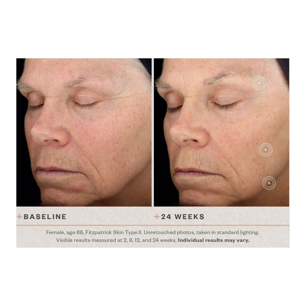 SkinMedica TNS Advanced+ Serum - Shopthatapp.ca