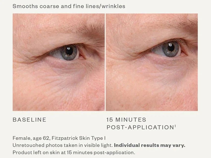 SkinMedica TNS Eye Repair - Shopthatapp.ca