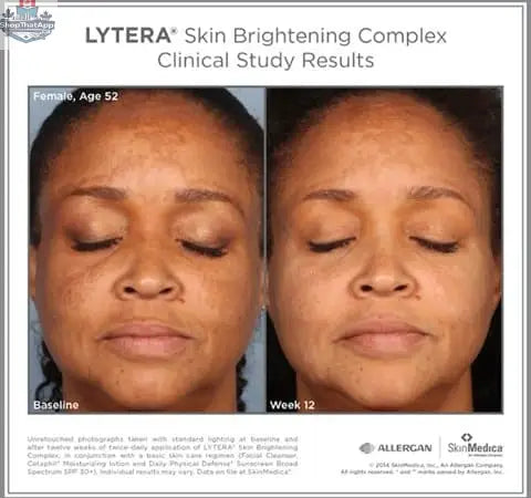 SkinMedica Lytera 2.0 Brightening Serum for even skin tone, shown in a sleek skincare bottle with a pump dispenser.