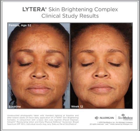 SkinMedica®Lytera 2.0 - Shopthatapp.ca