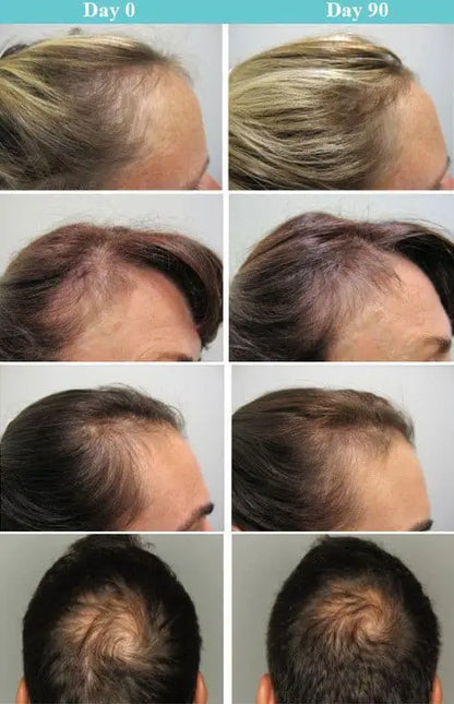 Viviscal Professional vitamins for hair growth by Monarch MD Medical Aesthetics, showing a bottle of hair care supplements.