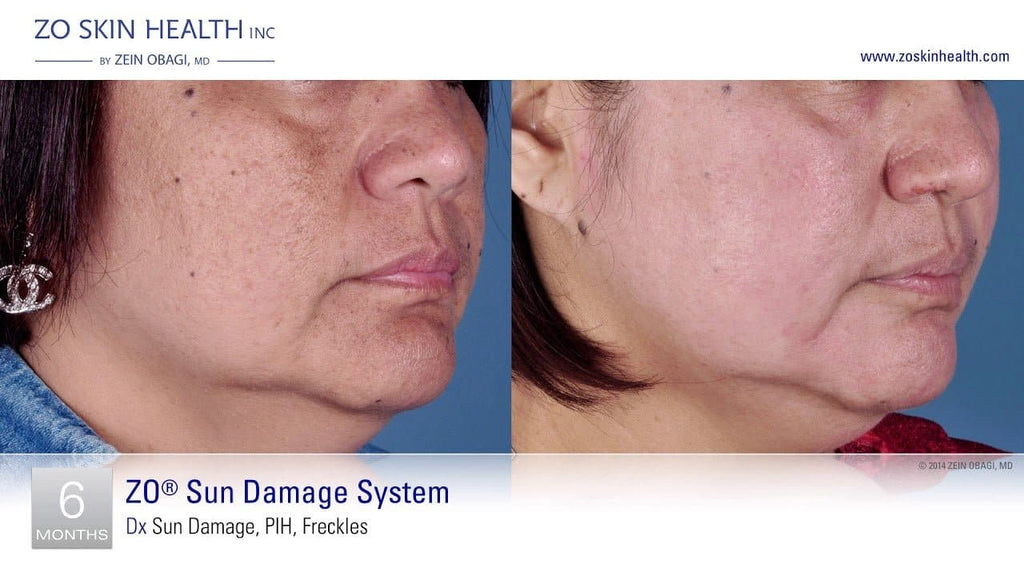ZO Firming Serum - Shopthatapp.ca