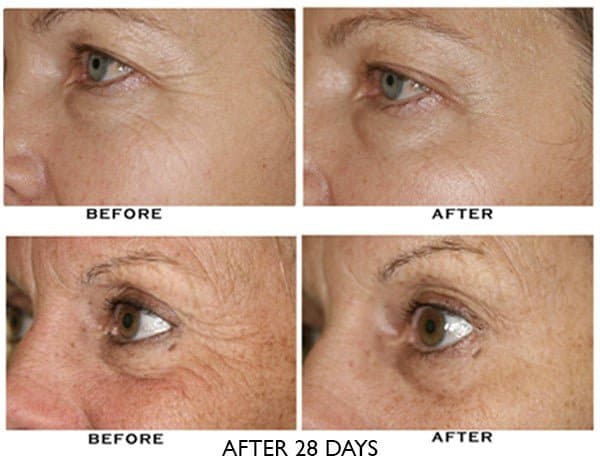 ZO Growth Factor Serum Eye - Shopthatapp.ca