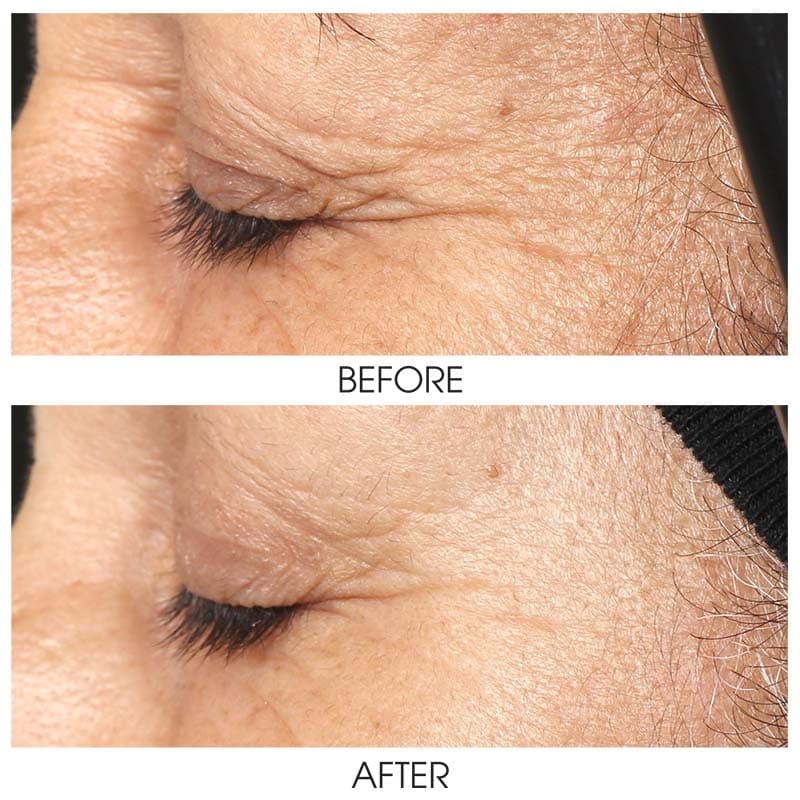 ZO Growth Factor Serum Eye - Shopthatapp.ca