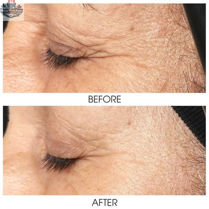 Botanical ZO Growth Factor Eye Serum bottle from Monarch MD Medical Aesthetics, designed for youthful, vibrant skin around the eyes.