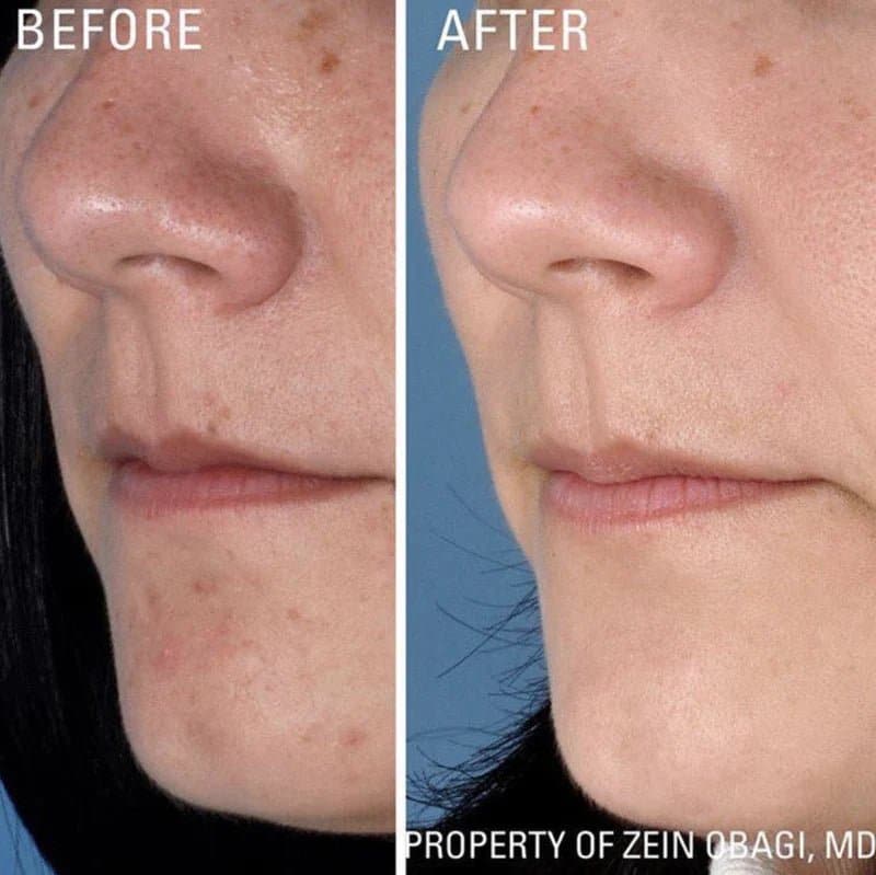 ZO Instant Pore Refiner - Shopthatapp.ca