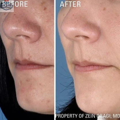 Close-up of Monarch MD ZO Instant Pore Refiner bottle, featuring sleek packaging for skin care pore refining treatment.