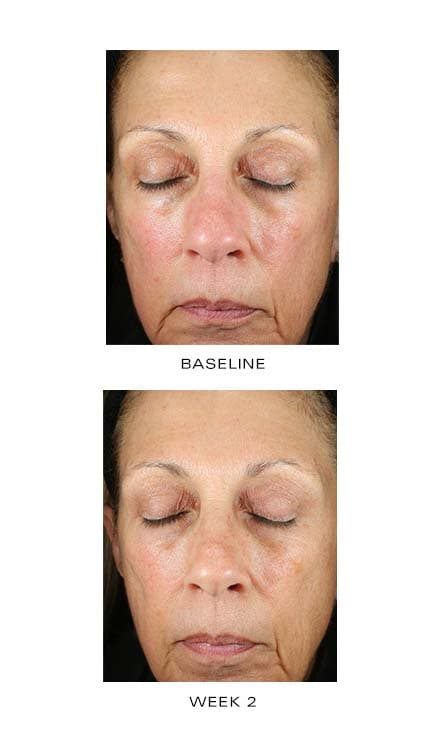 ZO Renewal Creme - Shopthatapp.ca