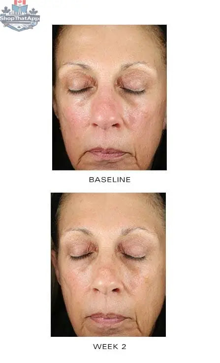 Zoom Renewal Creme by Monarch MD Medical Aesthetics, a skincare product in a sleek jar with a white and silver design.