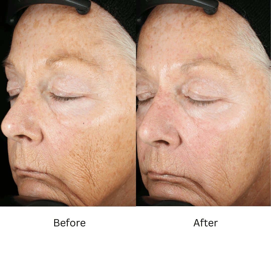 ZO Wrinkle and Texture Repair - Shopthatapp.ca
